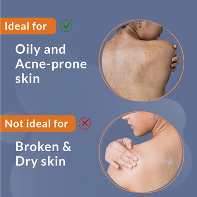 FIX DERMA SALYZAP-AZ
